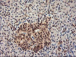 HSPBP1 Antibody in Immunohistochemistry (Paraffin) (IHC (P))