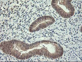 HSPBP1 Antibody in Immunohistochemistry (Paraffin) (IHC (P))