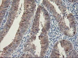 HSPBP1 Antibody in Immunohistochemistry (Paraffin) (IHC (P))