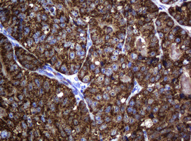 Hsp60 (HSPD1) Antibody in Immunohistochemistry (Paraffin) (IHC (P))