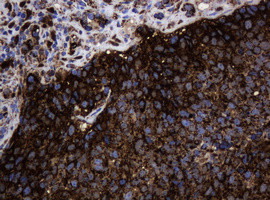 Hsp60 (HSPD1) Antibody in Immunohistochemistry (Paraffin) (IHC (P))