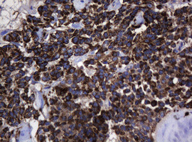 Hsp60 (HSPD1) Antibody in Immunohistochemistry (Paraffin) (IHC (P))