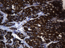 Hsp60 (HSPD1) Antibody in Immunohistochemistry (Paraffin) (IHC (P))