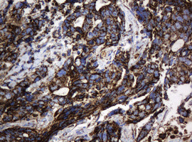 Hsp60 (HSPD1) Antibody in Immunohistochemistry (Paraffin) (IHC (P))