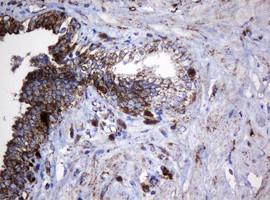 Hsp60 (HSPD1) Antibody in Immunohistochemistry (Paraffin) (IHC (P))