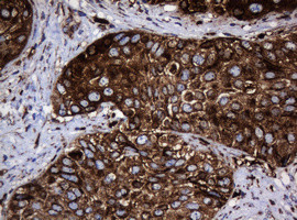 Hsp60 (HSPD1) Antibody in Immunohistochemistry (Paraffin) (IHC (P))