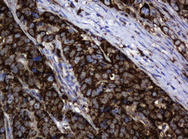 Hsp60 (HSPD1) Antibody in Immunohistochemistry (Paraffin) (IHC (P))