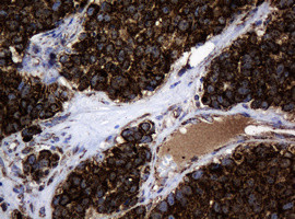 Hsp60 (HSPD1) Antibody in Immunohistochemistry (Paraffin) (IHC (P))