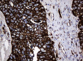 Hsp60 (HSPD1) Antibody in Immunohistochemistry (Paraffin) (IHC (P))