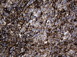 Hsp60 (HSPD1) Antibody in Immunohistochemistry (Paraffin) (IHC (P))