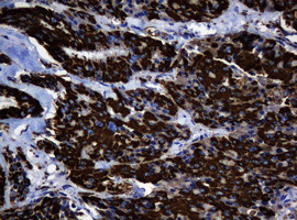 Hsp60 (HSPD1) Antibody in Immunohistochemistry (Paraffin) (IHC (P))