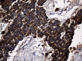 Hsp60 (HSPD1) Antibody in Immunohistochemistry (Paraffin) (IHC (P))