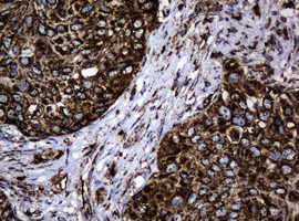 Hsp60 (HSPD1) Antibody in Immunohistochemistry (Paraffin) (IHC (P))