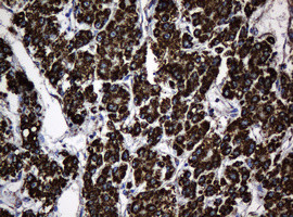 Hsp60 (HSPD1) Antibody in Immunohistochemistry (Paraffin) (IHC (P))