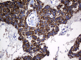 Hsp60 (HSPD1) Antibody in Immunohistochemistry (Paraffin) (IHC (P))