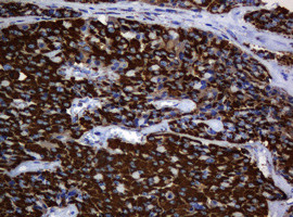 Hsp60 (HSPD1) Antibody in Immunohistochemistry (Paraffin) (IHC (P))