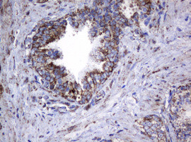 Hsp60 (HSPD1) Antibody in Immunohistochemistry (Paraffin) (IHC (P))