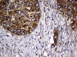 Hsp60 (HSPD1) Antibody in Immunohistochemistry (Paraffin) (IHC (P))