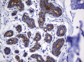 Hsp60 (HSPD1) Antibody in Immunohistochemistry (Paraffin) (IHC (P))