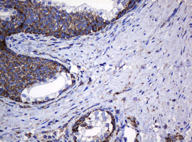 Hsp60 (HSPD1) Antibody in Immunohistochemistry (Paraffin) (IHC (P))