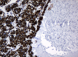 Hsp60 (HSPD1) Antibody in Immunohistochemistry (Paraffin) (IHC (P))