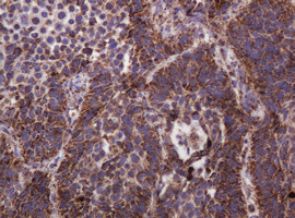 Hsp60 (HSPD1) Antibody in Immunohistochemistry (Paraffin) (IHC (P))