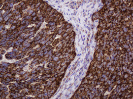 Hsp60 (HSPD1) Antibody in Immunohistochemistry (Paraffin) (IHC (P))