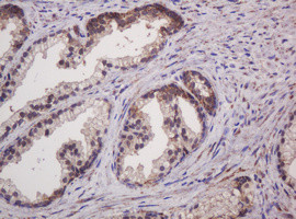 Hsp60 (HSPD1) Antibody in Immunohistochemistry (Paraffin) (IHC (P))