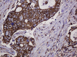 Hsp60 (HSPD1) Antibody in Immunohistochemistry (Paraffin) (IHC (P))