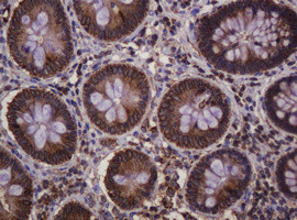 Hsp60 (HSPD1) Antibody in Immunohistochemistry (Paraffin) (IHC (P))