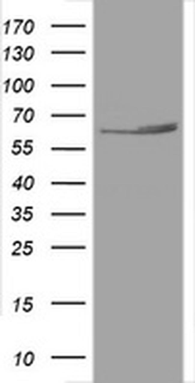 Hsp60 (HSPD1) Antibody in Western Blot (WB)