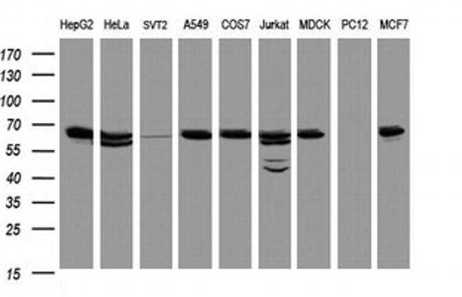 Hsp60 (HSPD1) Antibody in Western Blot (WB)