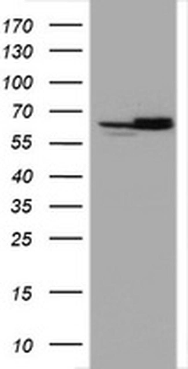 Hsp60 (HSPD1) Antibody in Western Blot (WB)