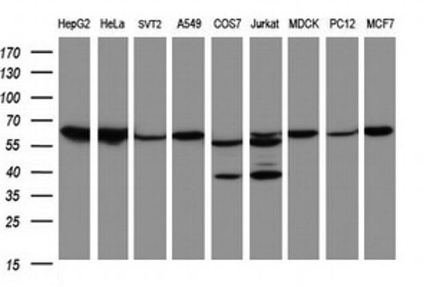 Hsp60 (HSPD1) Antibody in Western Blot (WB)