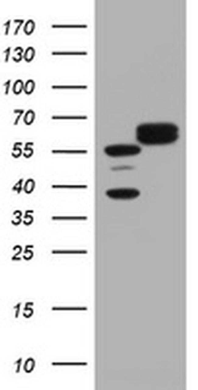 Hsp60 (HSPD1) Antibody in Western Blot (WB)