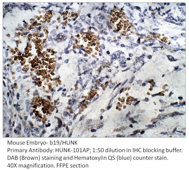 B19 Antibody in Immunohistochemistry (IHC)