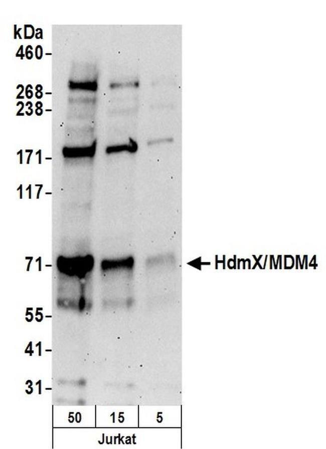 HdmX/MDM4 Antibody in Western Blot (WB)