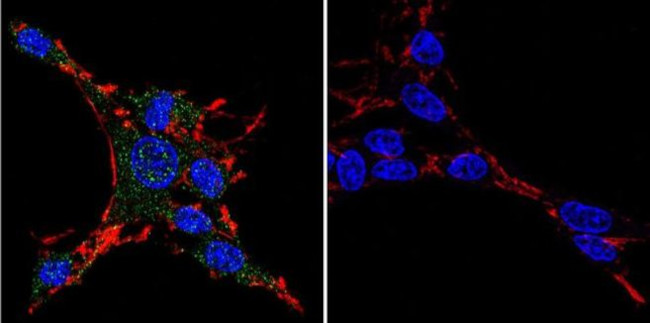 HSP27 Antibody in Immunocytochemistry (ICC/IF)