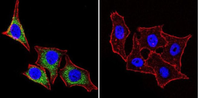 HSP27 Antibody in Immunocytochemistry (ICC/IF)