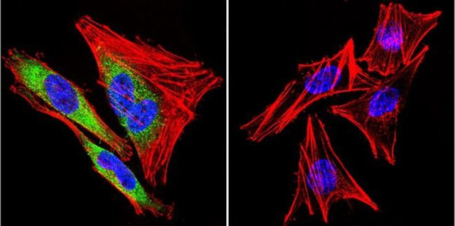 HSP90 beta Antibody in Immunocytochemistry (ICC/IF)