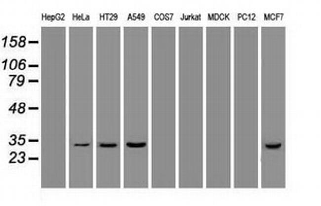 Hex Antibody in Western Blot (WB)