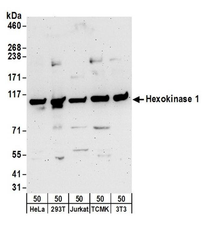 Hexokinase 1 Antibody in Western Blot (WB)