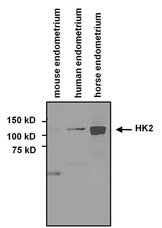 HK2 Antibody in Western Blot (WB)