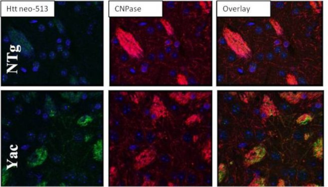 Huntingtin Antibody in Immunohistochemistry (IHC)