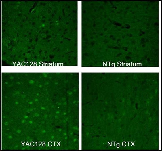 Huntingtin Antibody in Immunohistochemistry (IHC)