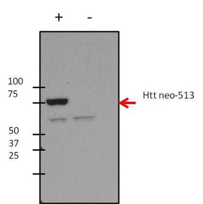 Huntingtin Antibody in Western Blot (WB)