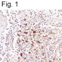 HHV-6 Envelope Antibody in Immunohistochemistry (Paraffin) (IHC (P))