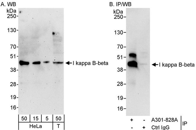 I kappa B-beta Antibody in Western Blot (WB)