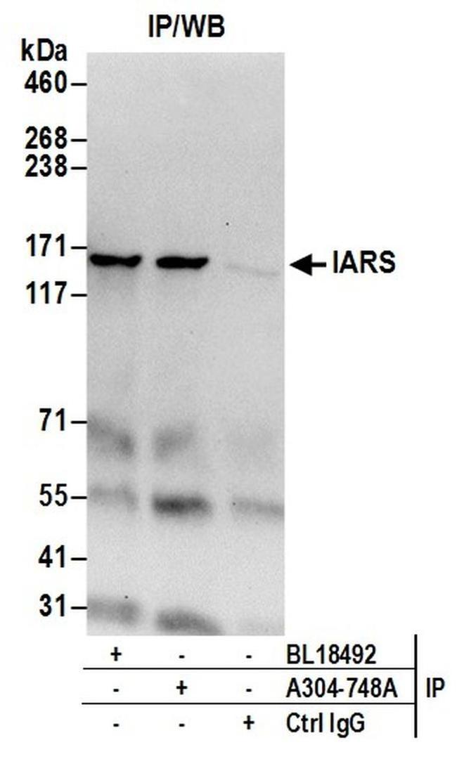 IARS Antibody in Western Blot (WB)