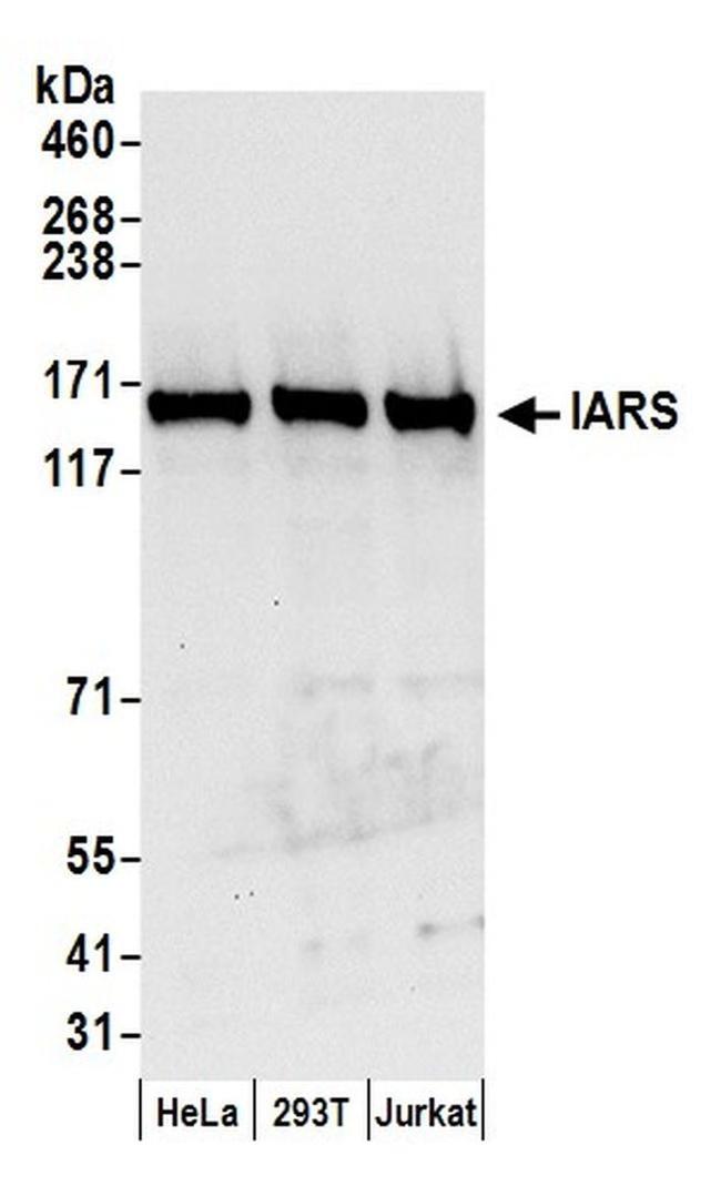 IARS Antibody in Western Blot (WB)